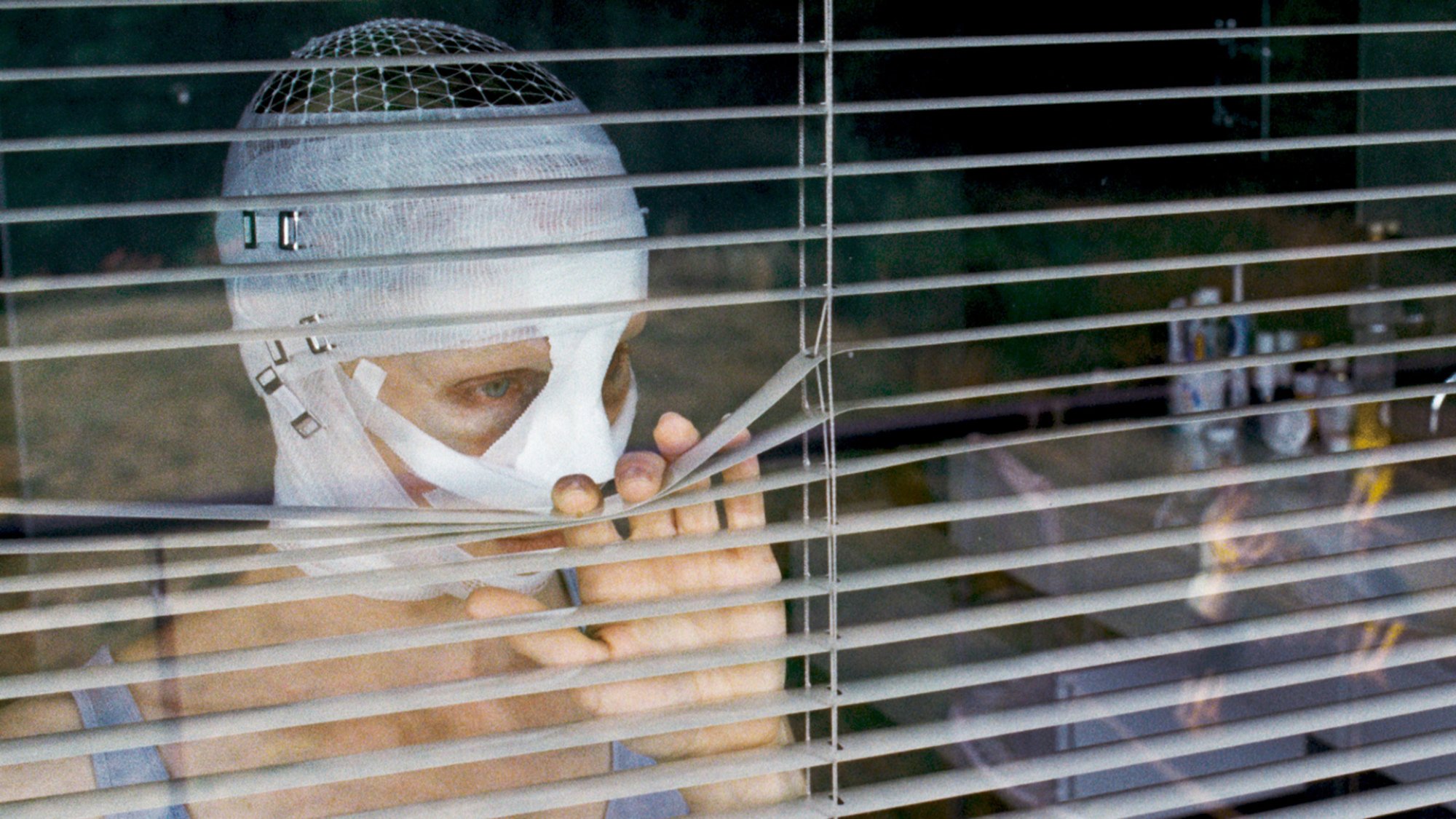 A woman in face bandages peers through blinds.