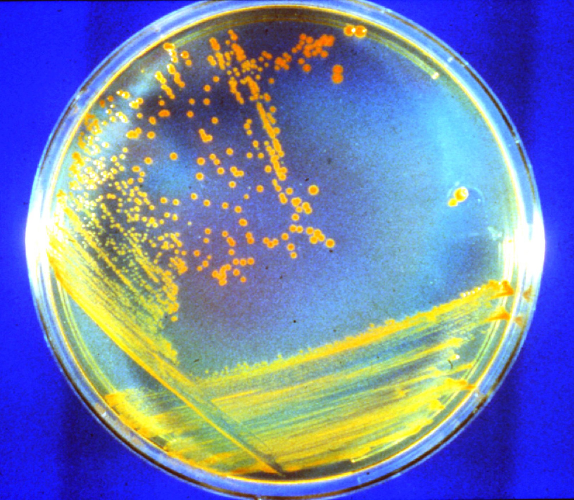 the microbe D. radiodurans growing on a plate.