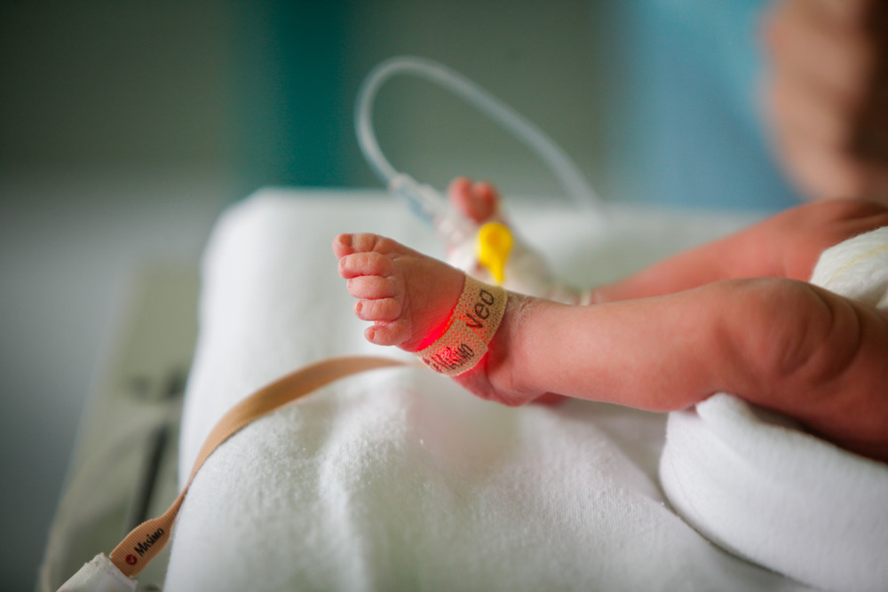 Premature Birth: Survival and Health Concerns